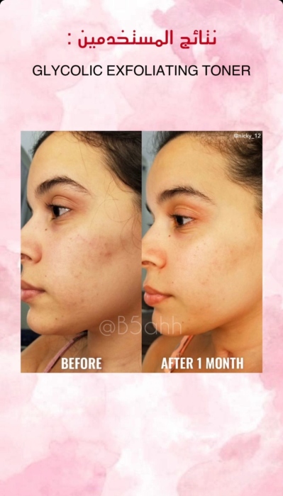 Good molecules, GLYCOLIC EXFOLIATING TONER  